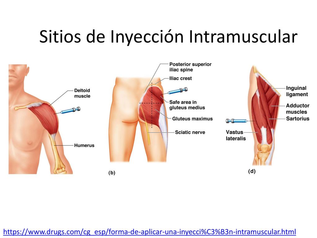 como aplicar una inyeccion intramuscular linear unit solfa syllable pierna